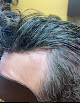 Your hair transplant and cost A Better You Hair Studio Llc - Men And Women Non Surgical Hair Replacement , Hair Salon Chattanooga Tn in Chattanooga in Tennessee