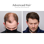 Your hair transplant and cost Advanced Hair Restoration in Oakbrook Terrace in IL