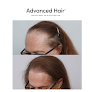 Your hair transplant and cost Advanced Hair Restoration in Northbrook in IL