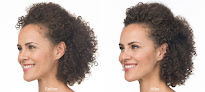 Your hair transplant and cost Aesthetic Med Studio in Springfield in Missouri