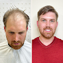 Your hair transplant and cost Allusions in Cincinnati in Ohio
