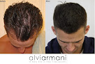Your hair transplant and cost Alvi Armani - Beverly Hills in Beverly Hills in California