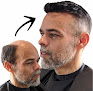 Your hair transplant and cost Apollo Hair & Wigs International in Minneapolis in Minnesota