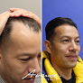 Your hair transplant and cost Avance Hair Transplant in Reno in Nevada