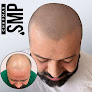 Your hair transplant and cost Chapman Smp in Ogden in Utah