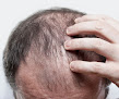 Your hair transplant and cost Cooley Hair Center in Charlotte in North Carolina