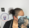 Your hair transplant and cost Delaware Scalp Micropigmentation in Wilmington in Delaware