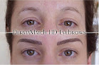 Your hair transplant and cost Dermamatch in Phoenix in Maricopa