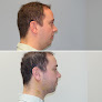 Your hair transplant and cost Finger And Associates Plastic Surgery Center in Savannah in Georgia