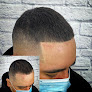 Your hair transplant and cost Fred312 Scalp Micropigmentation in Berwyn in IL