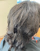 Your hair transplant and cost Hair And Scalp Wellness By Vito Mazza in Woodbridge in New Jersey
