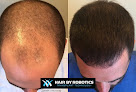 Your hair transplant and cost Hair By Robotics in Wichita in KS