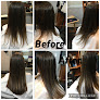 Your hair transplant and cost Hair Solutions Of Tampa in Tampa in Florida