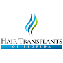 Your hair transplant and cost Hair Transplants Of Florida in Tampa in Florida