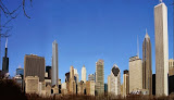Your hair transplant and cost Hair Trauma Center in Chicago in IL