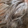 Your hair transplant and cost Hairclub in Elk Grove Village in IL