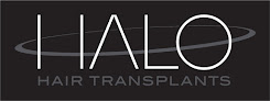 Your hair transplant and cost Halo Hair Transplants in Rochester in Minnesota