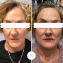 Your hair transplant and cost Image Medi-Spa in Fargo in North Dakota