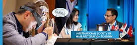 Your hair transplant and cost International Society Of Hair Restoration Surgery in Chicago in IL