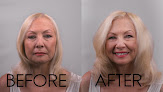Your hair transplant and cost Invisablend in Englewood in New Jersey