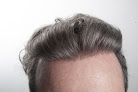 Your hair transplant and cost Invisions Of Connecticut in Middlebury in Connecticut