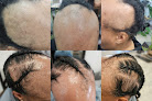 Your hair transplant and cost Khavoni's Mane Emerging Room Trichologist & Holistic Nutritionist in Tinley Park in IL