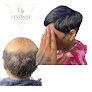 Your hair transplant and cost Levonye Professionals Llc in Glen Burnie in Maryland