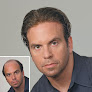 Your hair transplant and cost Lifelike Hair Center in Las Vegas in Nevada