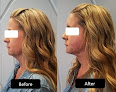 Your hair transplant and cost Mark N. Berkowitz, Md in Sterling Heights in Michigan