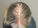 Your hair transplant and cost Massderm Hair Transplant Institute in Beverly in Massachusetts