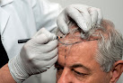 Your hair transplant and cost Miami Hair Transplant in Miami in Florida