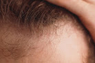 Your hair transplant and cost Michigan Hair Institute - Hair Transplant Clinic in Lincoln Park in Michigan