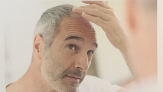 Your hair transplant and cost Minton Md Hair Restoration Center in Savannah in Georgia