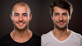 Your hair transplant and cost National Hair Centers in Phoenix in AZ