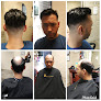 Your hair transplant and cost New Look Institute in San Jose in California