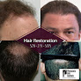 Your hair transplant and cost Physicians Hair Institute in Tucson in Pima