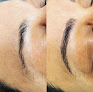 Your hair transplant and cost Professional Image And Laser Center Llc in Charlotte in North Carolina
