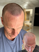 Your hair transplant and cost Rejuvenate Smp Scalp Micropigmentation in Midvale in Utah