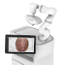 Your hair transplant and cost Renew Robotic Hair Transplant in Irving in Texas