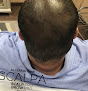 Your hair transplant and cost Scalp Aesthetics Dearborn in Dearborn in Michigan