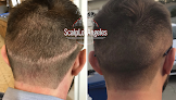 Your hair transplant and cost Scalp Los Angeles - Scalp Micropigmentation In Los Angeles in Sherman Oaks in California