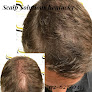 Your hair transplant and cost Scalp Solutions Kentucky in Louisville in KY