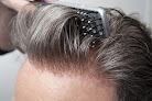 Your hair transplant and cost Shear Pointe Hair Restoration Center in Birmingham in Michigan