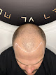 Your hair transplant and cost Smp Studio Boise in Boise in Idaho