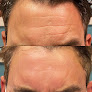 Your hair transplant and cost Source Of Health in Scottsdale in Maricopa
