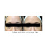 Your hair transplant and cost Spa 35 Med Spa in Boise in Idaho