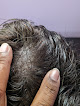 Your hair transplant and cost Superhairpieces in Sunrise in Florida