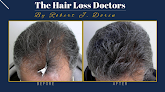 Your hair transplant and cost The Hair Loss Doctors in Short Hills in New Jersey