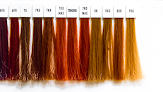 Your hair transplant and cost The Hair Specialists, Llc in Stow in Ohio
