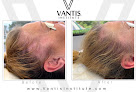 Your hair transplant and cost Vantis Institute in Newport Beach in California